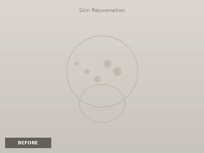 Skin Rejuvenation before and after