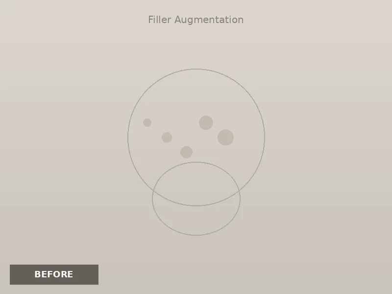 Thread Lift Results before and after